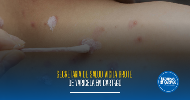 Secretaría de Salud vigila brote de varicela en Cartago