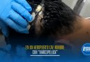 No pasó el control: descubren “narcopeluca” cargada de droga en aeropuerto